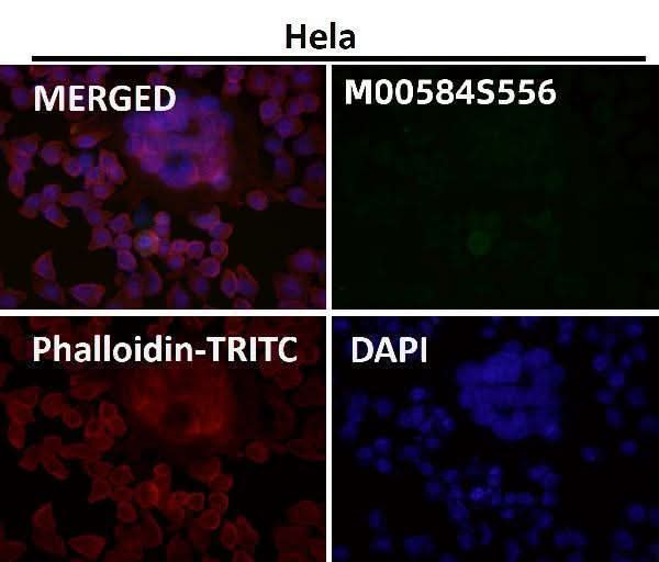 Anti-Phospho-ULK1 (S556) Rabbit Monoclonal Antibody Boster Bio