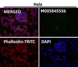 Anti-Phospho-ULK1 (S556) Rabbit Monoclonal Antibody Boster Bio