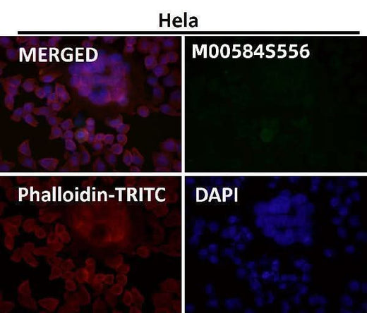 Anti-Phospho-ULK1 (S556) Rabbit Monoclonal Antibody Boster Bio