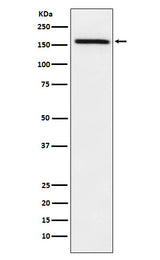 Anti-ADAMTS13 Rabbit Monoclonal Antibody Boster Bio