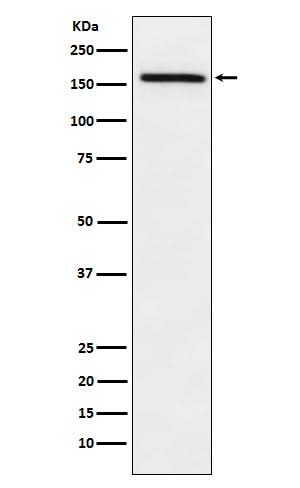 Anti-ADAMTS13 Rabbit Monoclonal Antibody Boster Bio