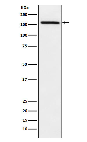 Anti-ADAMTS13 Rabbit Monoclonal Antibody Boster Bio