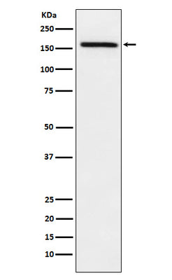 Anti-ADAMTS13 Rabbit Monoclonal Antibody Boster Bio