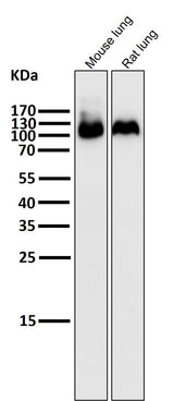 Anti-Integrin beta 3 ITGB3 Rabbit Monoclonal Antibody Boster Bio