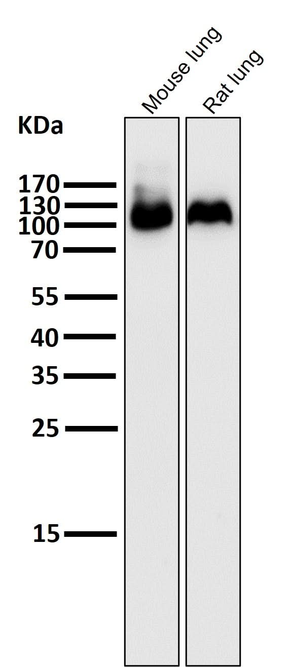 Anti-Integrin beta 3 ITGB3 Rabbit Monoclonal Antibody Boster Bio