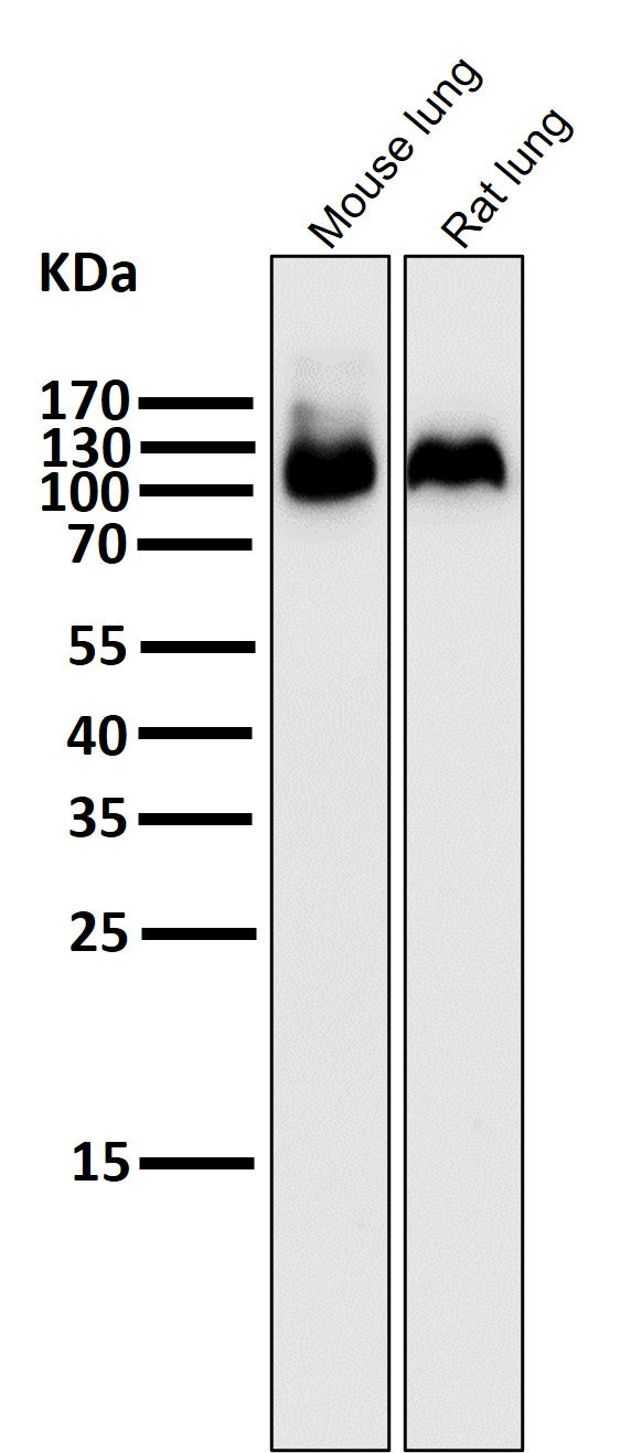 Anti-Integrin beta 3 ITGB3 Rabbit Monoclonal Antibody Boster Bio