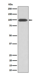 Anti-Integrin beta 3 / CD61 Rabbit Monoclonal Antibody Boster Bio