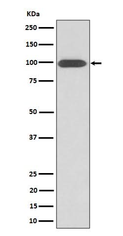 Anti-Integrin beta 3 / CD61 Rabbit Monoclonal Antibody Boster Bio