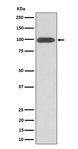 Anti-Integrin beta 3 / CD61 Rabbit Monoclonal Antibody Boster Bio