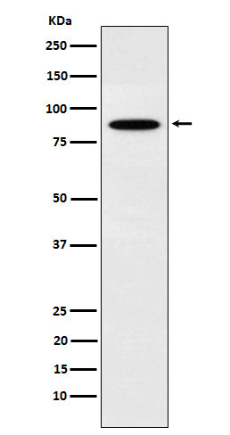 Anti-EWSR1 Rabbit Monoclonal Antibody Boster Bio