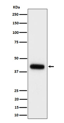Anti-Clusterin Rabbit Monoclonal Antibody Boster Bio