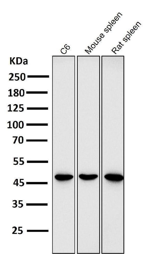 Anti-GATA3 Rabbit Monoclonal Antibody Boster Bio