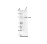 Anti-CD26/DPP4 Rabbit Monoclonal Antibody Boster Bio