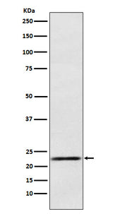 Anti-Prolactin Rabbit Monoclonal Antibody Boster Bio
