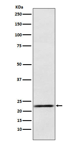 Anti-Prolactin Rabbit Monoclonal Antibody Boster Bio
