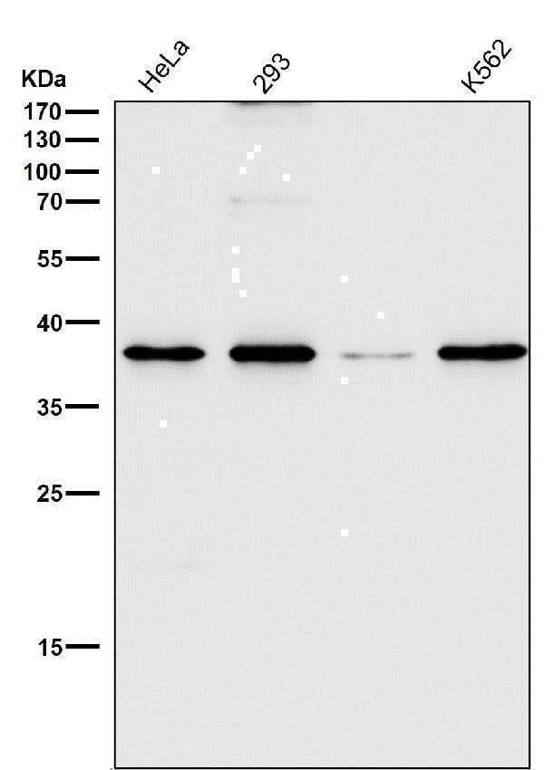 Anti-CD68/Sr D1 Rabbit Monoclonal Antibody Boster Bio