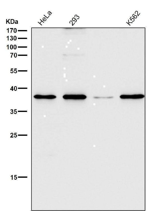 Anti-CD68/Sr D1 Rabbit Monoclonal Antibody Boster Bio