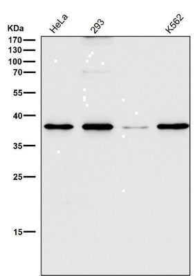 Anti-CD68/Sr D1 Rabbit Monoclonal Antibody Boster Bio