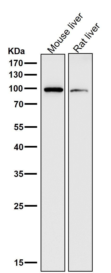 Anti-ADAM17/Tace Rabbit Monoclonal Antibody Boster Bio
