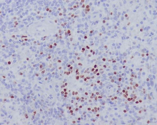 Anti-LEF1 Rabbit Monoclonal Antibody Boster Bio