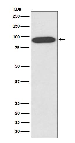 Anti-VCP Rabbit Monoclonal Antibody Boster Bio