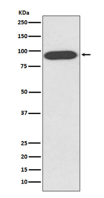 Anti-VCP Rabbit Monoclonal Antibody Boster Bio