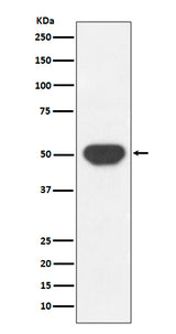 Anti-PTP1B PTPN1 Rabbit Monoclonal Antibody Boster Bio