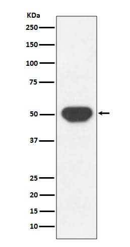 Anti-PTP1B PTPN1 Rabbit Monoclonal Antibody Boster Bio