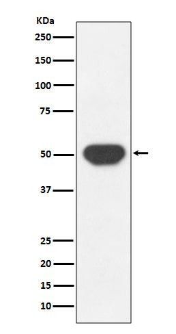 Anti-PTP1B PTPN1 Rabbit Monoclonal Antibody Boster Bio