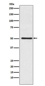 Anti-Cytochrome P450 17A1 Rabbit Monoclonal Antibody Boster Bio