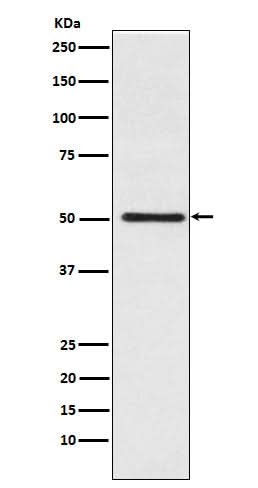 Anti-Cytochrome P450 17A1 Rabbit Monoclonal Antibody Boster Bio
