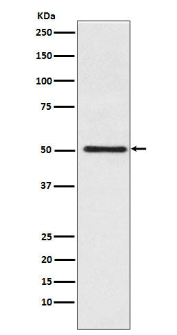 Anti-Cytochrome P450 17A1 Rabbit Monoclonal Antibody Boster Bio