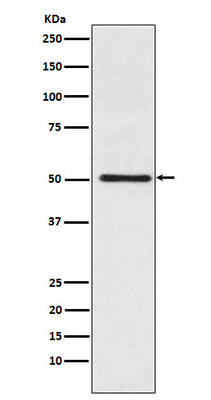 Anti-Cytochrome P450 17A1 Rabbit Monoclonal Antibody Boster Bio