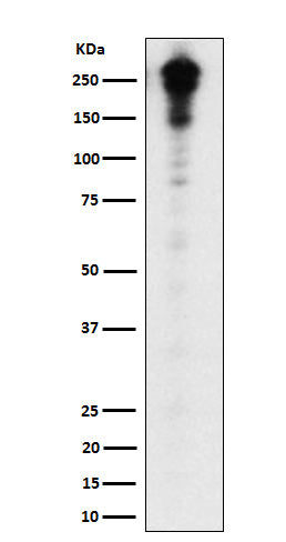 Anti-Desmoplakin Rabbit Monoclonal Antibody Boster Bio