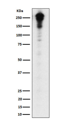 Anti-Desmoplakin Rabbit Monoclonal Antibody Boster Bio