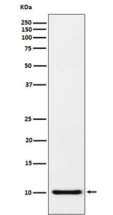 Anti-RANTES CCL5 Monoclonal Antibody Boster Bio