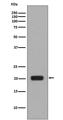 Anti-MCSF Rabbit Monoclonal Antibody Boster Bio