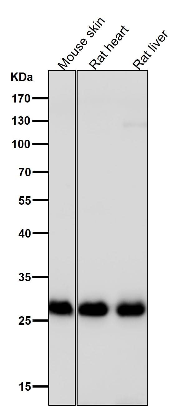 Anti-Galectin 3 LGALS3 Rabbit Monoclonal Antibody Boster Bio