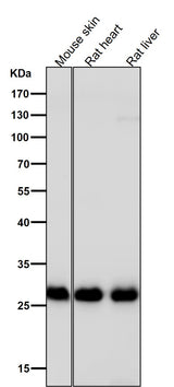 Anti-Galectin 3 LGALS3 Rabbit Monoclonal Antibody Boster Bio