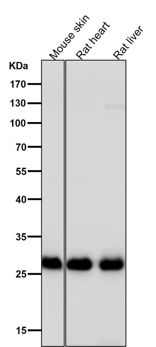 Anti-Galectin 3 LGALS3 Rabbit Monoclonal Antibody Boster Bio