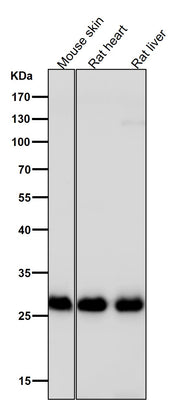 Anti-Galectin 3 LGALS3 Rabbit Monoclonal Antibody Boster Bio