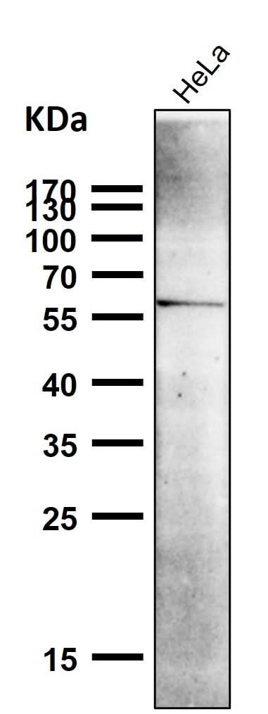 Anti-NUR77 NR4A1 Rabbit Monoclonal Antibody Boster Bio