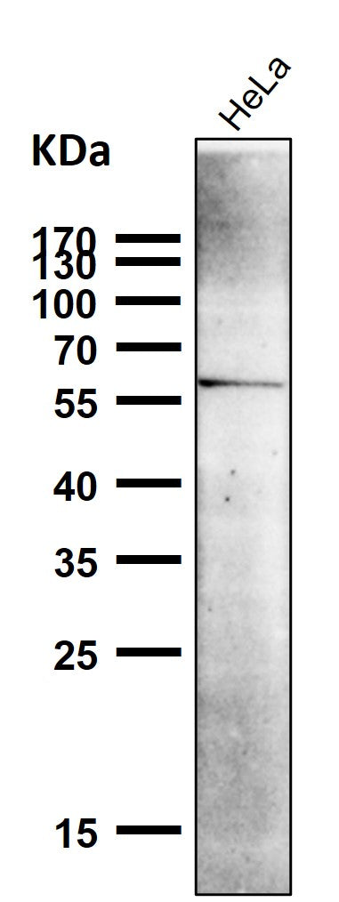 Anti-NUR77 NR4A1 Rabbit Monoclonal Antibody Boster Bio