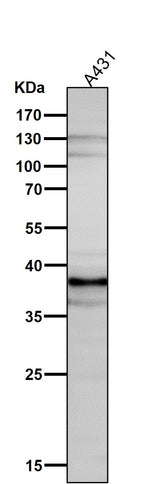 Anti-DKK1 Rabbit Monoclonal Antibody Boster Bio