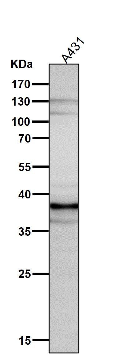 Anti-DKK1 Rabbit Monoclonal Antibody Boster Bio