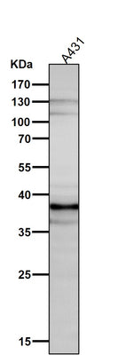 Anti-DKK1 Rabbit Monoclonal Antibody Boster Bio