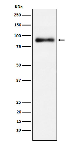 Anti-Lactoferrin Rabbit Monoclonal Antibody Boster Bio