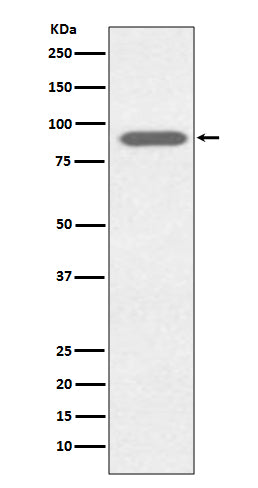 Anti-Lactoferrin LTF Rabbit Monoclonal Antibody Boster Bio