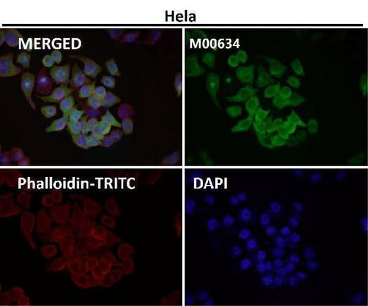 Anti-Osteopontin SPP1 Rabbit Monoclonal Antibody Boster Bio