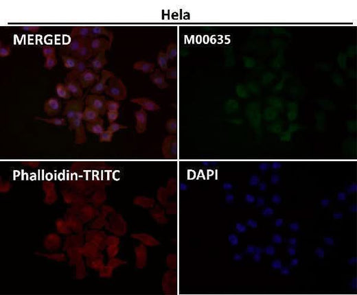 Anti-PRMT5 Rabbit Monoclonal Antibody Boster Bio